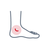 MDI Pain - Ankle