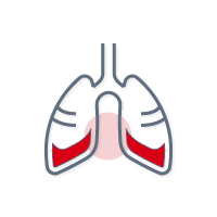 MDI Pain - Lung