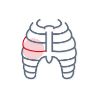 MDI Pain - Rib